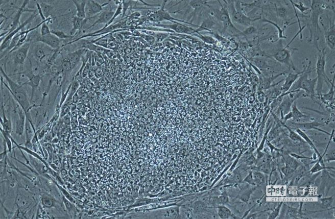美國俄勒岡健康科學大學研究小組以女性提供的卵子植入他人皮膚細胞核的體細胞複製技術，首度成功製作了可分化成各種組織的胚胎幹細胞（美聯社）。