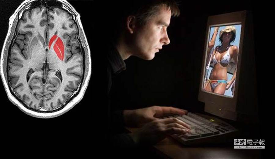 [圖]