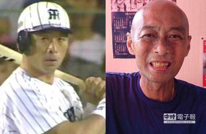旅日球员陈大丰(右图为罹病后所摄)过世，享年51岁。(图摘自网路)