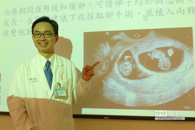 中國附醫生殖醫學中心主任何彥秉提出「選擇性緩和試管」新療法，幫助求子民眾。（林欣儀攝）