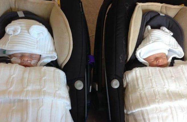 鏡像雙胞胎非常罕見。（圖／育兒小百科）