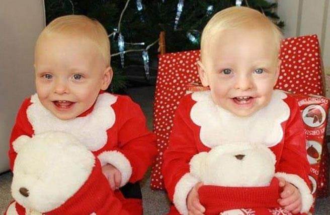 而鏡像雙胞胎影響的層面不單只有內臟的位置，連外貌也會受到影響。（圖／育兒小百科）