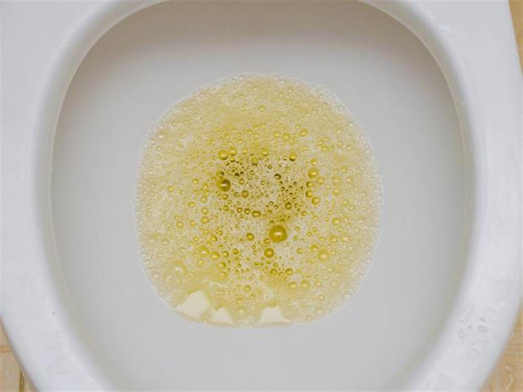 泡沫尿泡的特写 尿培养试验或检验用尿样 库存照片. 图片 包括有 宏指令, 叫化子, 肥皂, 背包, 起泡的 - 182418118