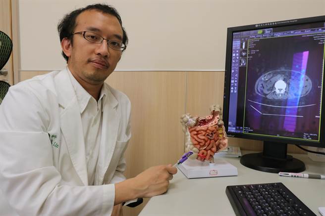 亞大醫院大腸直腸外科主治醫師林敬淳，藉由模型指出腸套疊位置。（林欣儀攝）