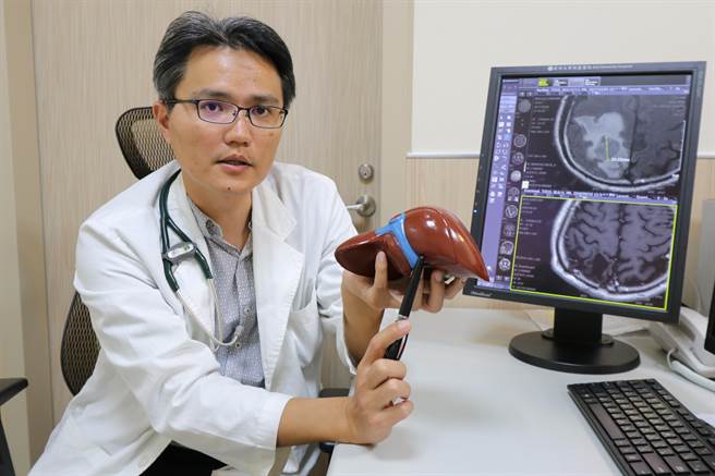 亞大醫院肝膽胃腸科主任陳政國指出腫瘤位置。(林欣儀攝)