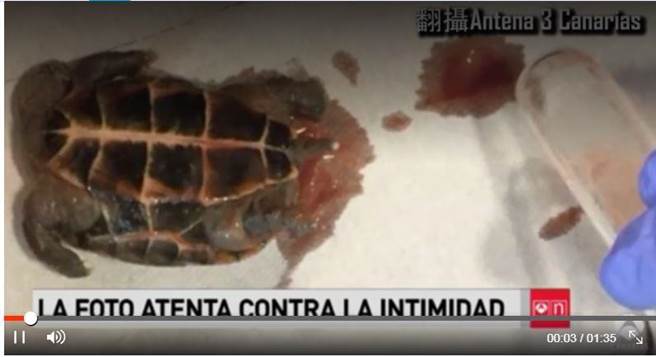 一名26歲英國女子上周在西班牙特內里費島參加派對後，腹部劇烈疼痛，就醫發現她的下體被人塞入一隻烏龜。醫師手術從女子陰道取出烏龜的照片最近曝光。翻攝《Antena 3 Canarias》