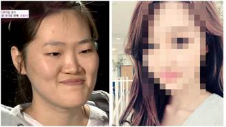 膽小者甚入！韓國「整形版」醜女大翻身 網友：根本看不出來是同一個人