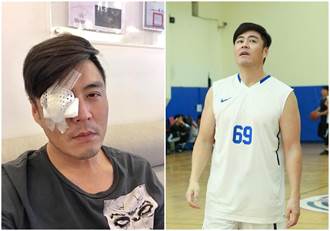 劉至翰才動青光眼手術 為公益上籃球場：劉家男人都中了