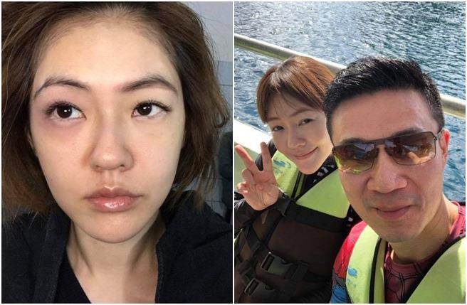 小s臉傷遭傳家暴連媽媽也懷疑 尪第一反應讓她傻眼 娛樂 中時新聞網