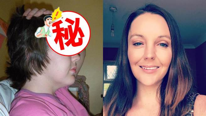 妹子搭车伸脚爽跷仪表板 下场「额头消失2年」（图／翻摄自Gráinne Kealy脸书）