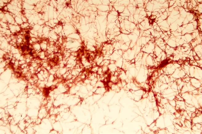 放線菌(Actinomycetes)(示意圖/達志影像)