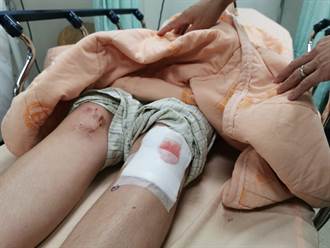 高中生騎車遭流浪狗衝撞 雙膝撕裂送醫開刀