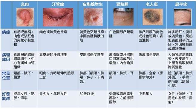 一張圖秒懂 醫師曝6皮膚症狀完治之道 生活 中時新聞網