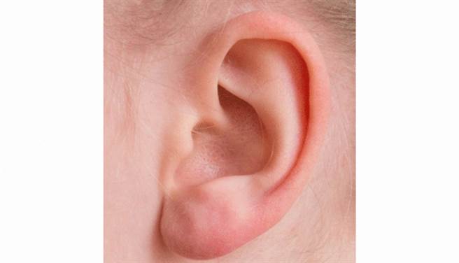 棉花棒傷耳膜用4招溫和清耳朵 生活 中時新聞網