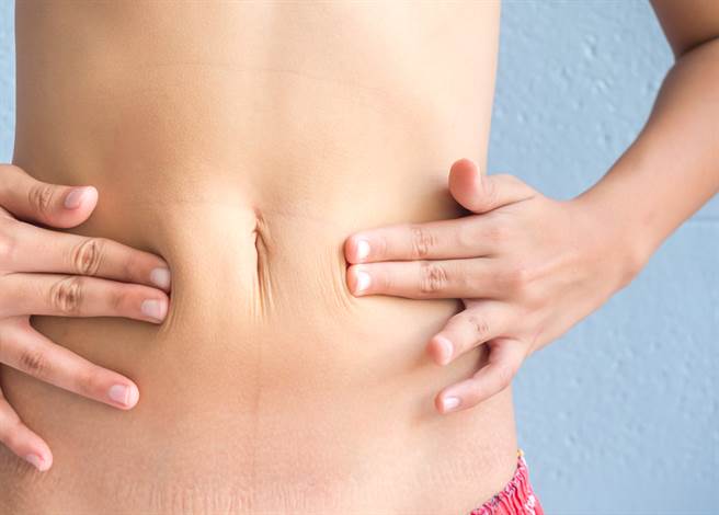 形状类似一条缝，几乎看不到肚脐眼的「海蛇形」肚脐最危险。(示意图/达志影像)