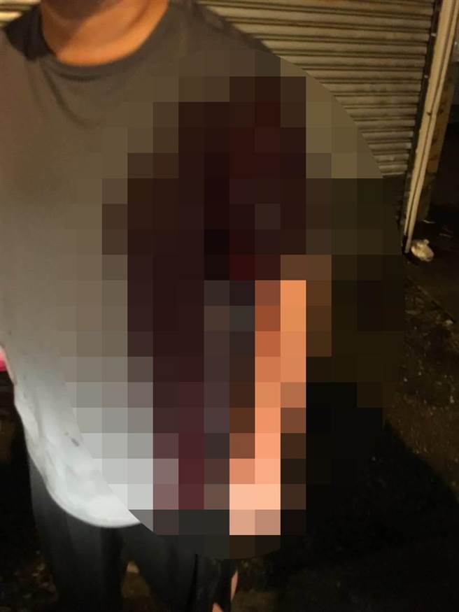 黃男左手背遭刺傷，流滿鮮血。（翻攝畫面／程炳璋台南傳真）