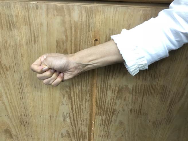 握拳30秒再張開，可簡單測試血管彈性。(徐秀娥攝)
