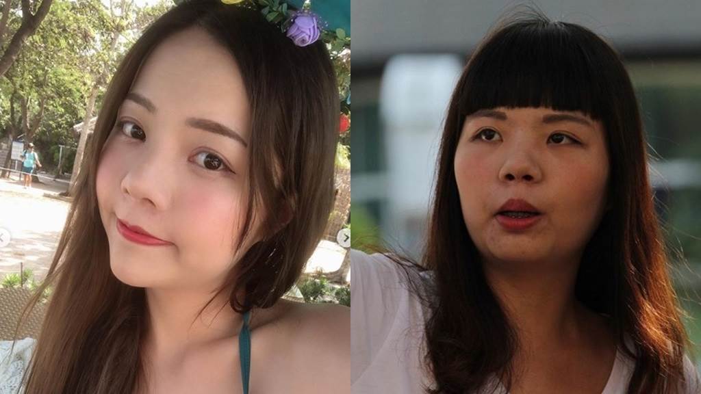 正妹整型上癮 手捧e胸 公開隆乳高清圖 緊緊的感覺 名人 時尚