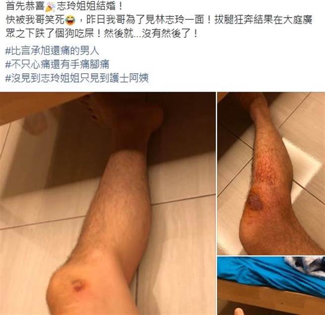 這名網友爆料自己哥哥為了見女神林志玲一面而摔到滿身傷。（摘自臉書社團《爆廢公社公開版》）