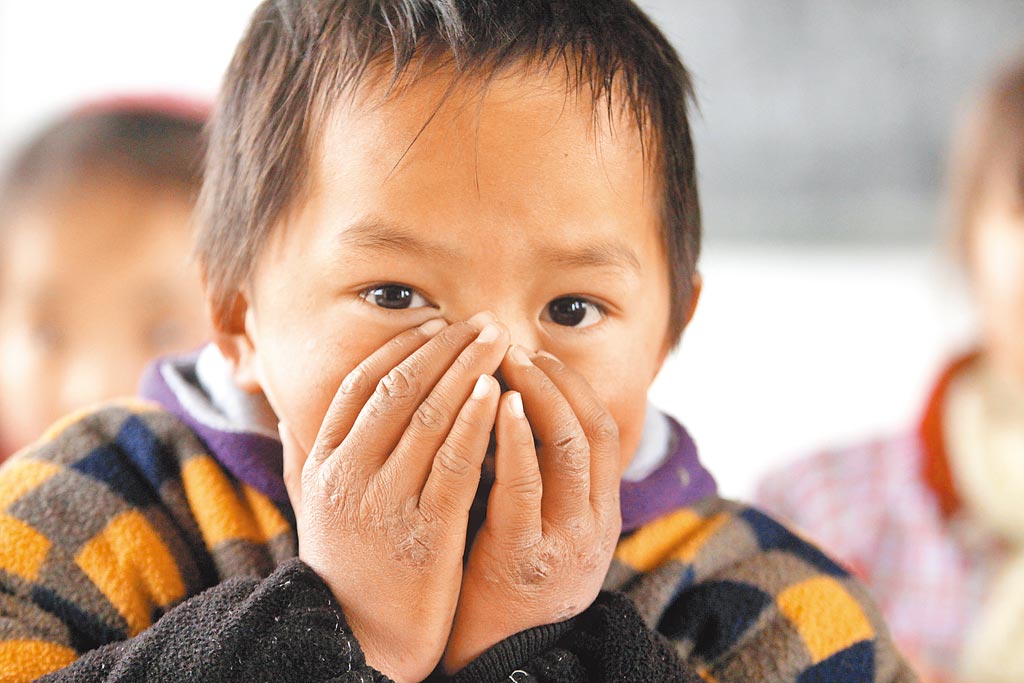 安徽省固鎮縣油坊小學冬天沒有電燈、設施簡陋的孩子們手上、臉上都長有不同程度的凍瘡。（中新社資料照片）