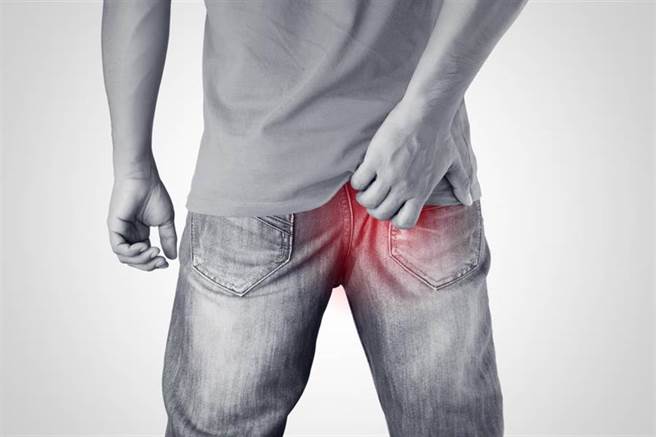 屁股奇癢無比 醫傻：全在肛門口蠕動(示意圖/達志影像)