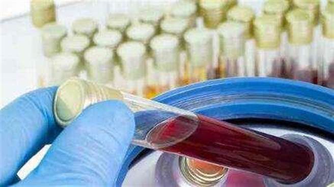 血漿療法治療新冠病毒，WHO認為：非常有效但需把握時機。（新浪網）