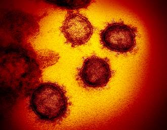 美國開始用伊波拉病毒出血熱治療藥進行新冠病毒的臨床試驗