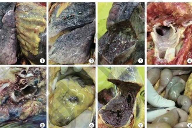 新冠肺炎遺體解剖肺部附著漿糊般液體 兩岸 中時新聞網