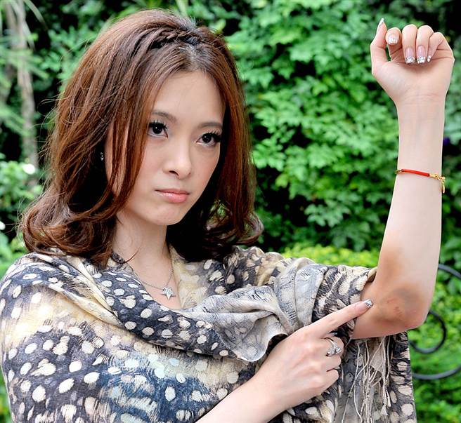 据传刘真目前仅剩30公斤。(本报系资料照)