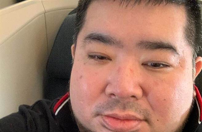 拓也哥目前人在加护病房治疗。（图／拓也哥IG）