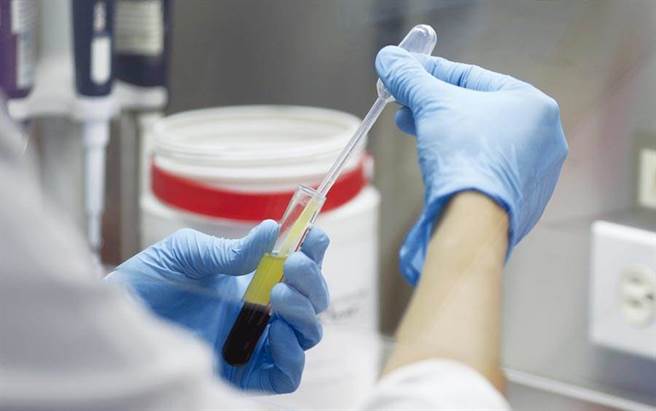 法国最新研究发现，抗疟疾老药「奎寧」加上抗生素「日舒」，号称5天可清除100%病毒。(示意图／美联社)