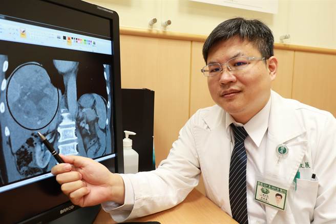 台中慈濟醫院一般外科主任余政展說明田先生的肝腫瘤位置。（王文吉攝）