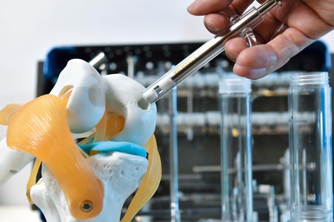 博晟生醫以來自工研院與臺大醫院共同研發的「兩相材料軟硬骨關節修復技術」，研發出國內首件自主研發的再生醫學產品，約40分鐘即可完成，減少住院成本和降低病患傷痛感，已在今年取證上市，可造福更多患者。圖／工研院提供