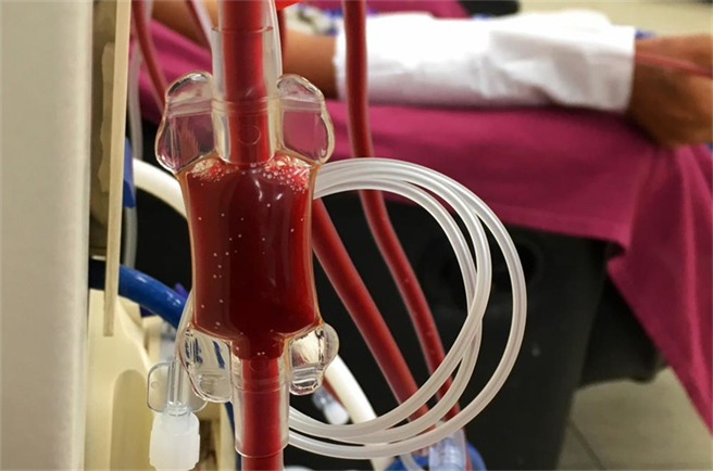 他曝捐骨髓曝过程生不如死！一句话让网友哭了。(示意图/达志影像)