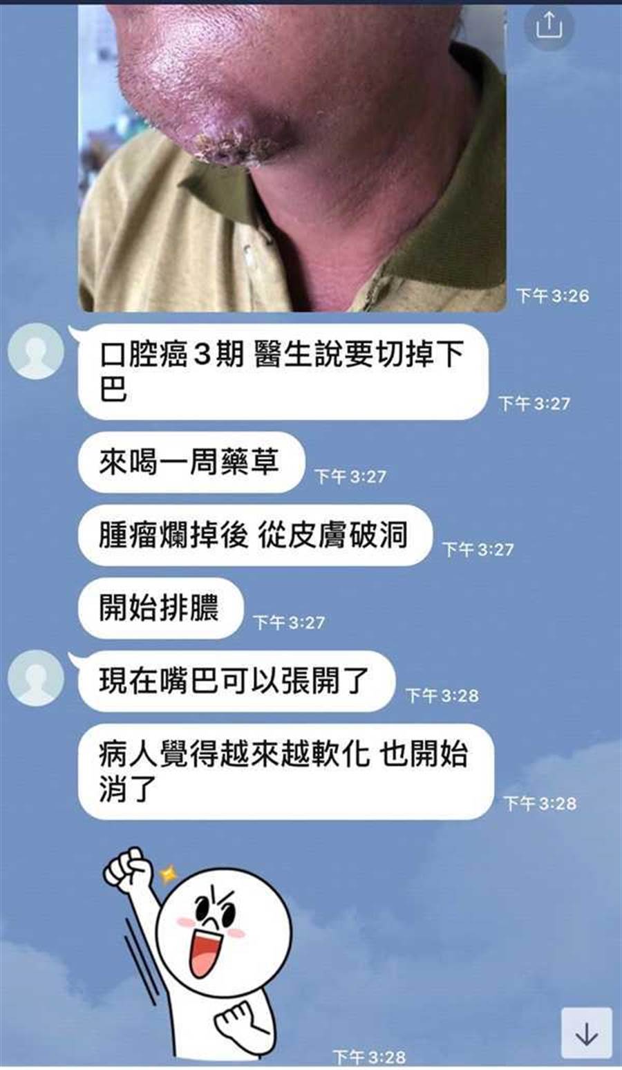 根據鄭勝哲與友人的對話紀錄，他洋洋得意宣稱，有口腔癌三期患者喝他的草藥而開始排膿，庸醫行徑讓人髮指。（圖／讀者提供）