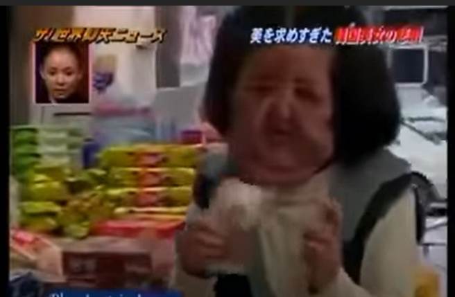 韩景慧脸部严重肿胀变形，整个人头大身小不成比例。(取自日网)