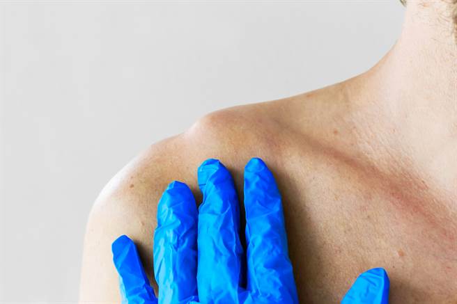 爱熬夜滑手机，一名12岁男童锁骨竟长出如鸟蛋大的肿块，医师一验惊呆。示意图非当事人。(达志影像)