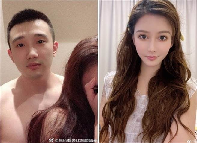 2天射7次爆红！实况主女友被打到手脚全废，惊悚照片曝光。（图／截自超凡电竞LOL微博）