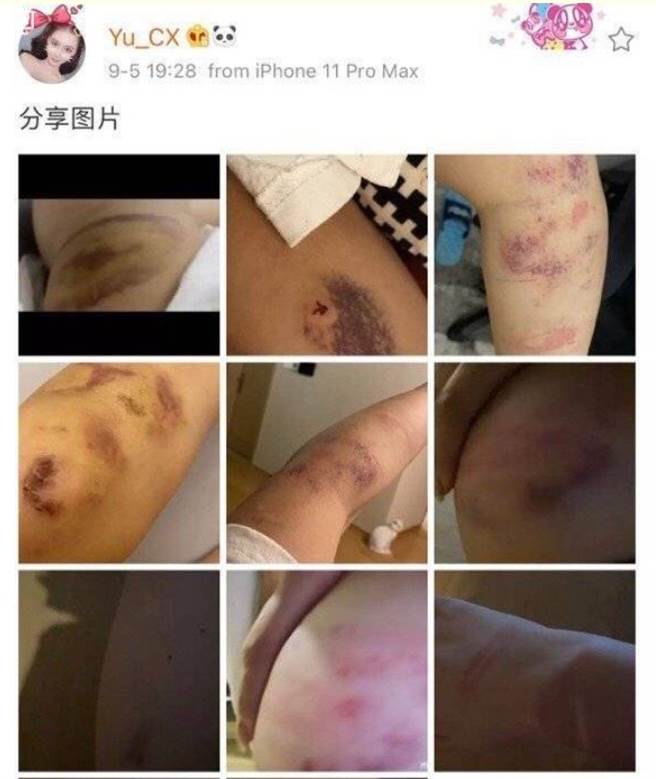 「死亡宣告」女友PO出自己被打的恐怖伤照。（图／截自微博）