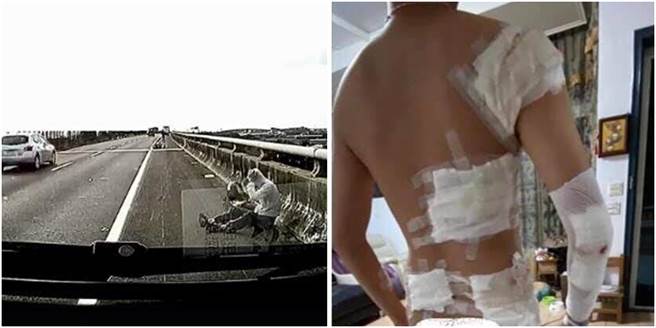 重機騎士遭水產店貨車逼車，全身多處擦傷，他透露若是當時他躺下，必死無疑。（圖/翻攝自爆料公社）