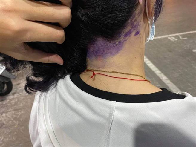 店家失手将染料弄到她的头皮与脖子，图片可见明显紫色区块。（脸书社团《爆怨公社》／苏育宣翻摄）