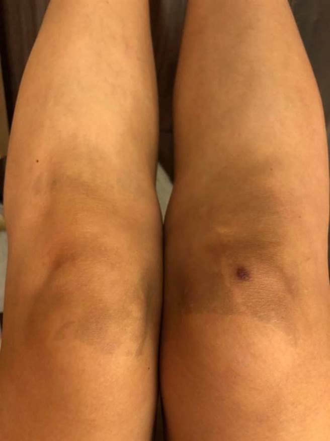 原PO穿完自卖场买的牛仔裤一整天后竟发现，两边的膝盖也都呈现黑色，连用肥皂洗都洗不掉。（摘自Costco好市多 商品经验老实说）