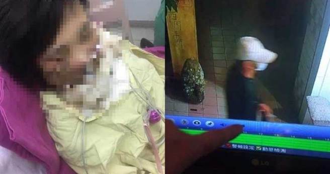 女网友4年前遭泼酸，凶手至今仍未遭逮。（图／翻摄自爆废公社）