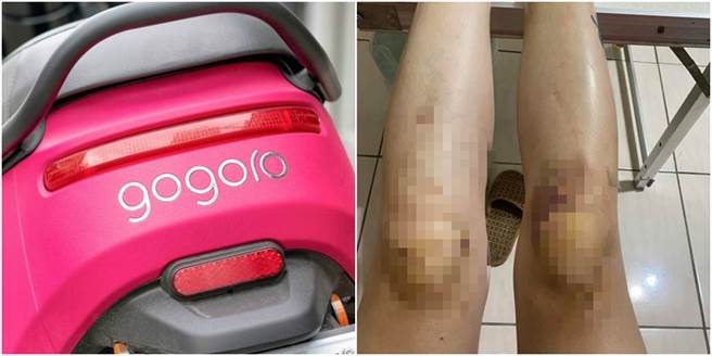 一名正妹骑gogoro惨摔，造成膝盖骨大片瘀青，而维修师的说法却让她不能接受。（图／合成图，左为示意图、达志影像、翻摄自爆料公社）