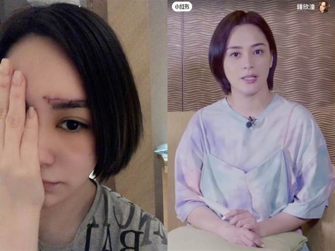 WJ6阿娇受伤后日前顶着短髮拍影片，未料被酸肿了有婶味。（图／翻摄自微博）