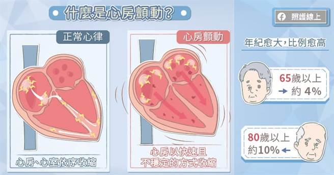 (图/照护线上提供)