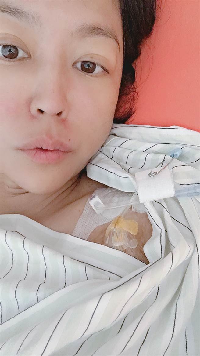 唐玲化疗时装人工血管。(照片/唐玲 提供)