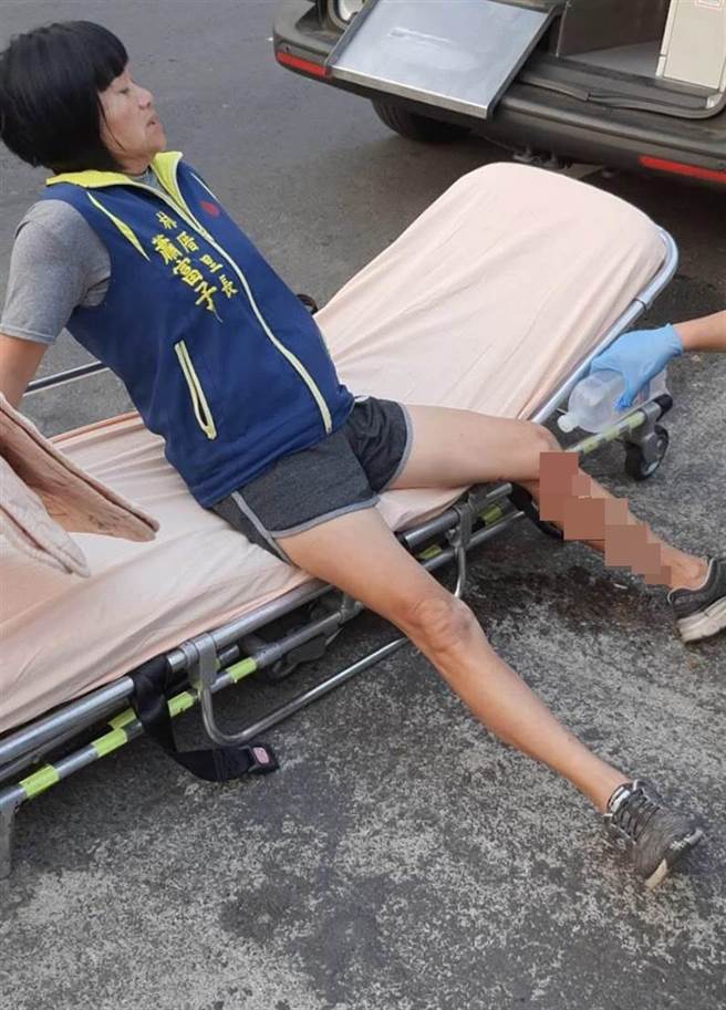 清晨带小柴犬出门运动的员林林厝里长萧富子遇野狗攻击狠咬，一脸惊恐坐上担架被119消防救护车送医检伤包扎。（摘自脸书／谢琼云彰化传真）