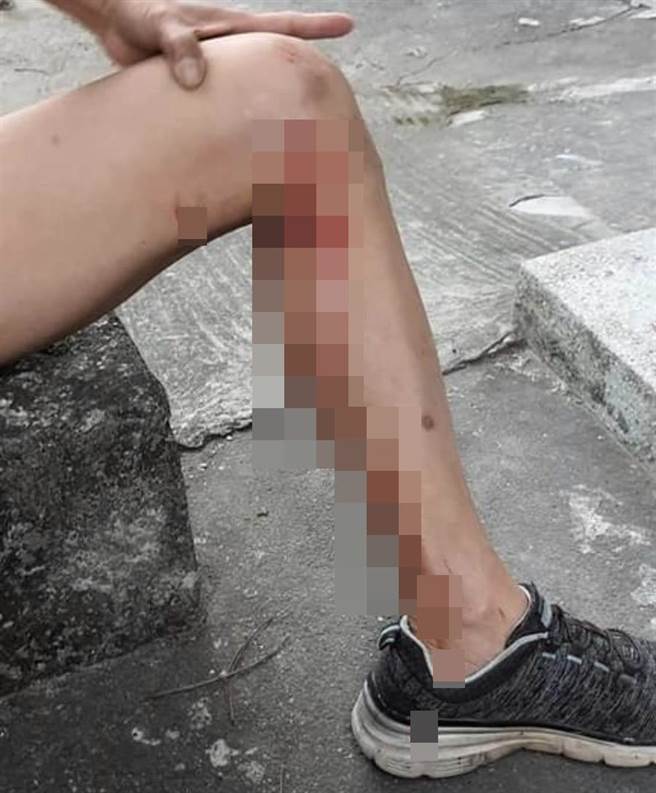 员林市林厝里长萧富子清晨至员南路运动遛狗，惨早大型流浪犬咬伤，左膝血流如注。（摘自脸书／谢琼云彰化传真）