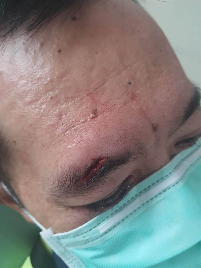 员警右眼角受伤，经送医治疗后无碍。（台中市警第三分局提供／张妍溱台中传真）